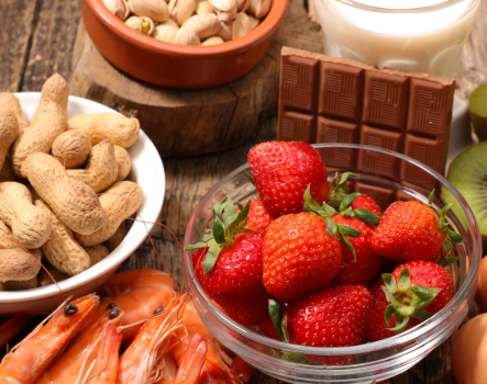 Top 5 Common Food Intolerance Triggers and How to Manage Them