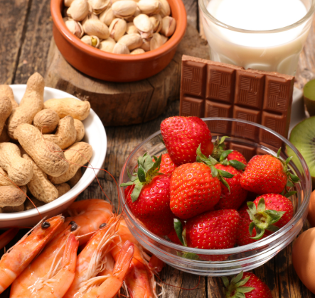 Top 5 Common Food Intolerance Triggers and How to Manage Them